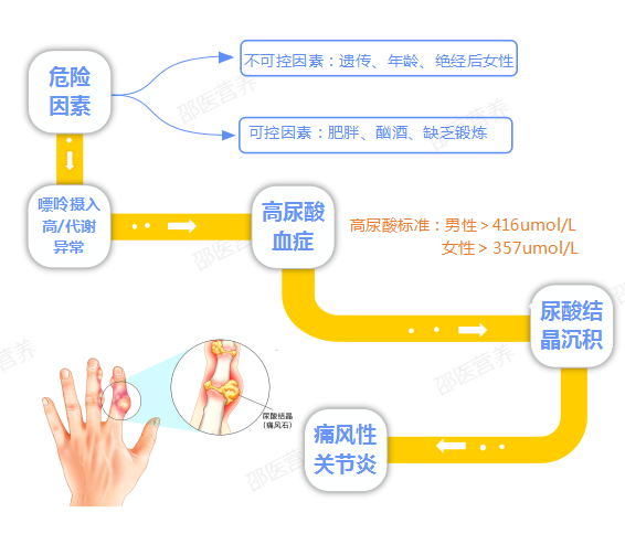 痛風(fēng)為什么偏愛男性？你最關(guān)心的問題都在這里
