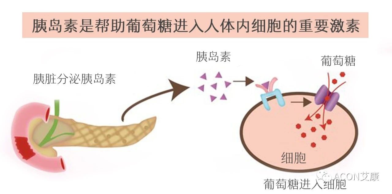 爆上熱搜，因爆發(fā)型糖尿病進(jìn)入ICU，有哪些教訓(xùn)值得我們汲取