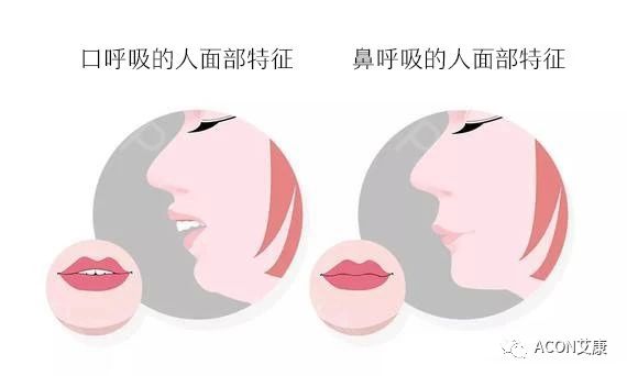 過(guò)敏性鼻炎會(huì)讓孩子變傻？！家長(zhǎng)該如何應(yīng)對(duì)